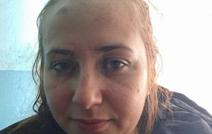 Муж жестоко избил жену из-за ремонта: женщина отказалась клеить с ним обои в новогоднюю ночь