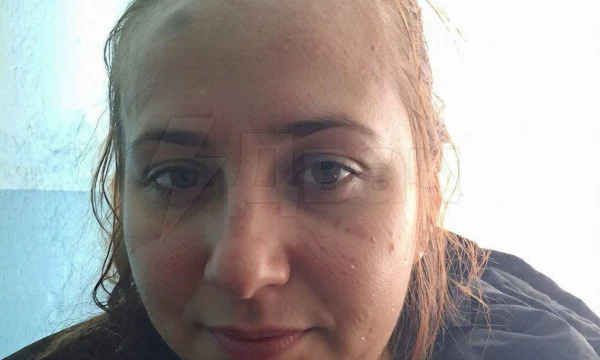 Муж жестоко избил жену из-за ремонта: женщина отказалась клеить с ним обои в новогоднюю ночь